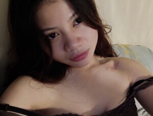 Thumb 1